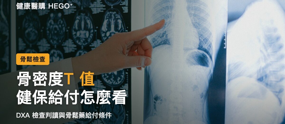 骨密度 T 值怎麼看？DXA 檢查與健保骨鬆藥給付條件